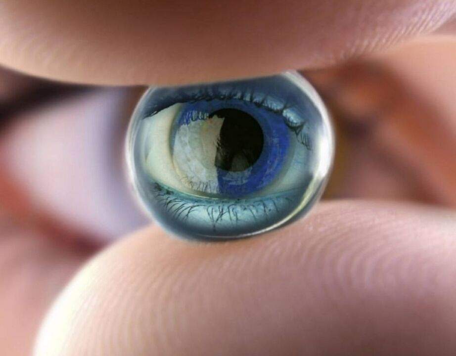 Nacht orthokeratologische lenzen zullen de voortgang van de visuele beperking stoppen